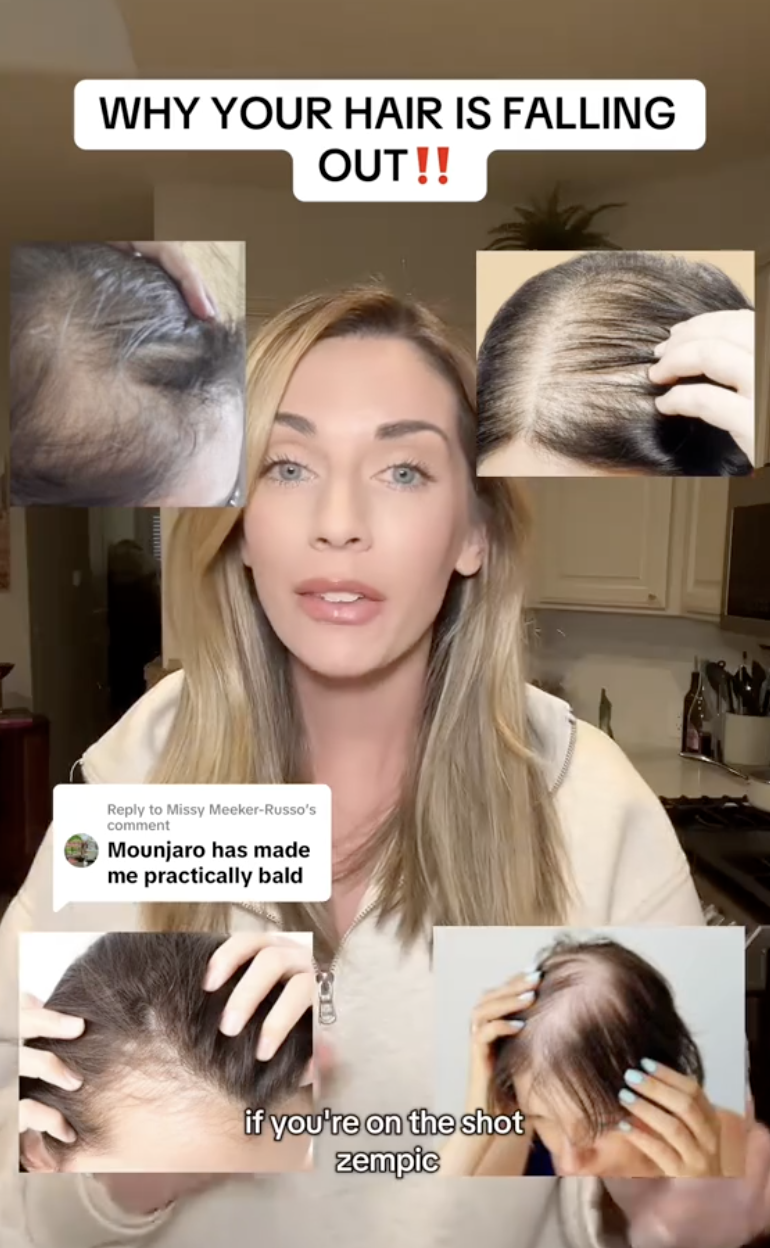 woman speaking about hair loss